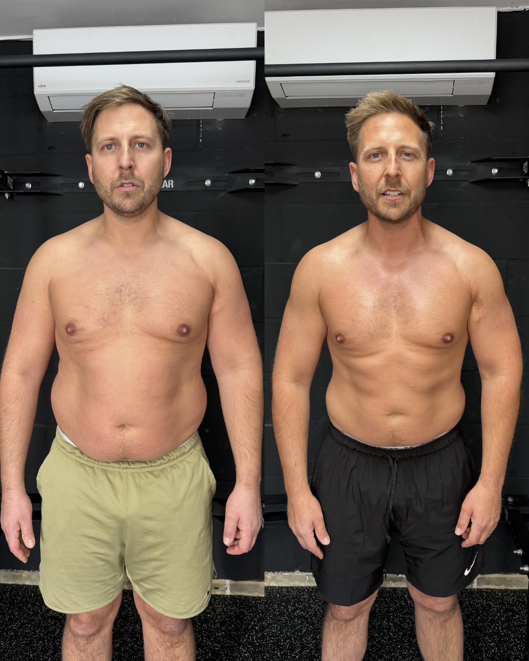 Before and after — Conrad, 90 days